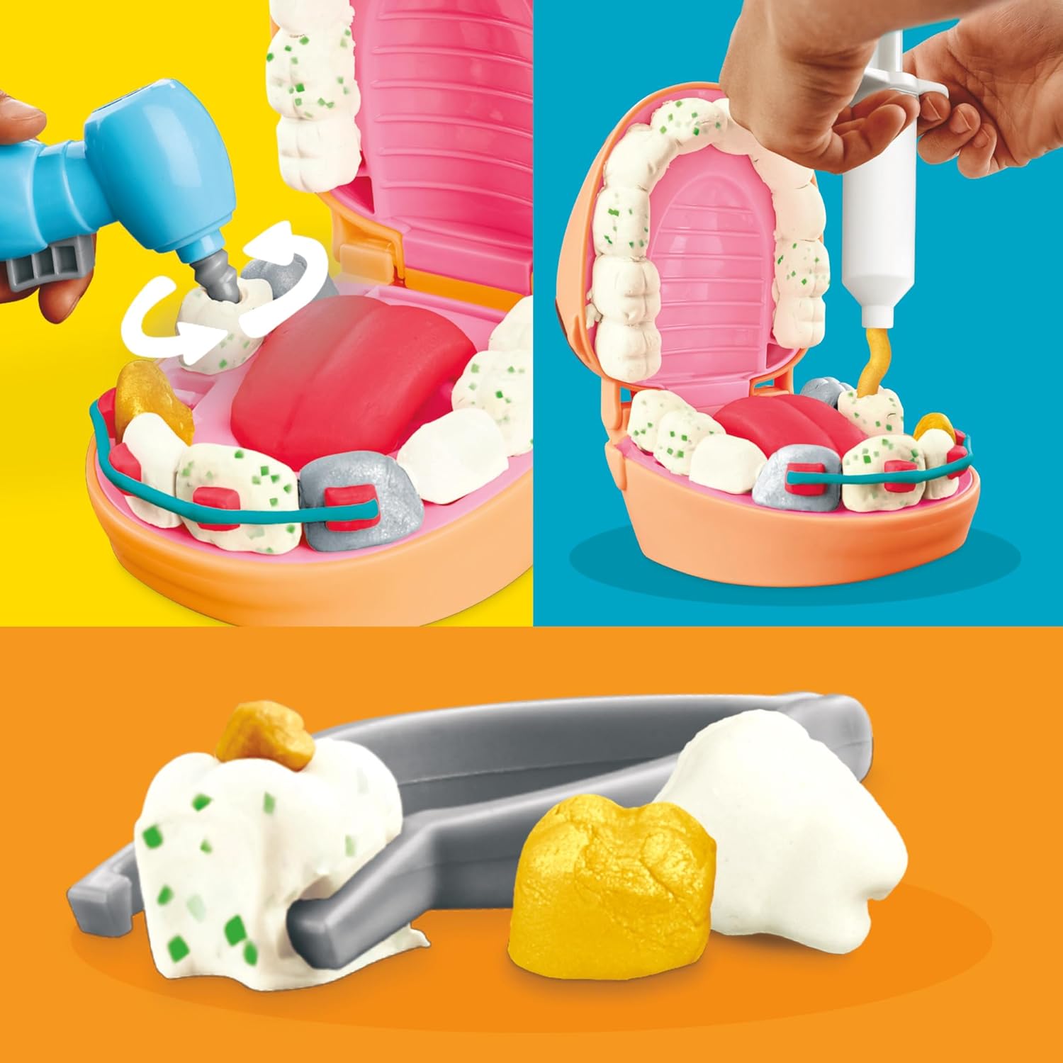 Play-Doh Dentist Dr. Drill ‘n Fill Toy Set for Children Aged 3+ with Caries Clay and Metal Coloured Clay, 10 Modelling Tools, 8 x 56g Tubs – Bild 3