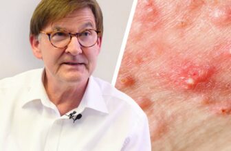 Akne ist ein Warnsignal: Interview mit Prof. Bodo Melnik
